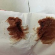 孕期咖啡色（怀孕初期有褐色的东西是什么原因）