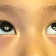 九个月宝宝眼袋看起来好重,九个月胎儿图片