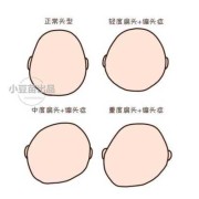 胎儿头大聪明（胎儿头大聪明还是头小聪明）