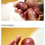 19周孩子可不可以打掉,怀孕19周胎儿稳定了吗正常吗