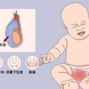 胎儿鞘膜积液（胎儿鞘膜积液是什么原因造成的）