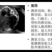 胎儿超声切面（NT超声孕龄13W＋1d是什么意思）