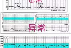 孕妇做胎心监护时，宝宝心率很高是怎么回事,孕晚期胎儿心率快是怎么回事