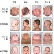 为什么胎儿头会偏大（婴儿头偏大，什么原因）