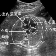 胎儿左心房强光点（胎儿左心房强光点一般多少周消失）