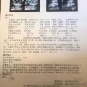胎儿肌动脉（彩超pi和ri是什么意思）
