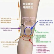 孕妇膝盖疼痛是怎么了？我现在疼的都没法走路了，好难受啊,孕期关节疼怎么办