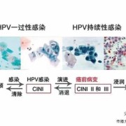孕妇得了支原体感染应该怎么办,孕期感染hpv会传染给胎儿吗