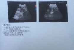 孕期照彩超（孕期照彩超多了好不好）
