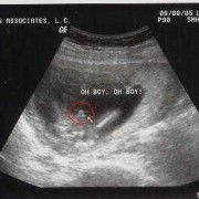 怀孕20周男孩胎儿图片（怀孕20周男孩胎儿图片）
