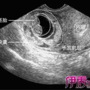 胎儿胎压（孕早期胚芽是什么）