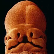 怀孕几个月胎儿长眼睛（怀孕几个月胎儿长眼睛鼻子）