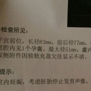 胎儿停育原因（胚胎停育是什么意思？什么原因会导致胚胎停）