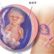 17周胎儿位置（17周胎儿位置示意图）