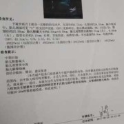 胎儿胆囊偏大有什么影响（四维彩超胎儿胆囊偏大有什么影响）