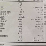 孕妇尿检酸碱度7.5正常吗,怀孕验尿数值