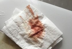 易孕期出血是正常的吗（易孕期出血是正常的吗）