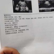 我做四维彩超结果是胎儿颈部见u型压迹这是什么意思,胎儿颈部未见u型压迹什么意思正常吗