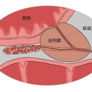 尿热是什么原因,孕期小便热是怎么回事