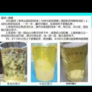 孕期验尿（孕期验尿要空腹吗）