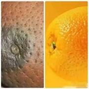 孕期乳房按摩后乳晕两侧发黑正常吗,怀孕期间乳晕的变化是什么