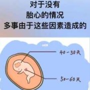 胎儿没有胎心（胎儿没胎心是什么原因，是什么原因导致的呢）