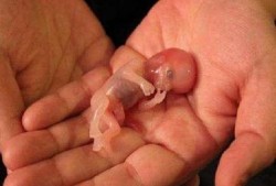 4个月胎儿的模样是什么样子的？都发育什么了,打掉的胎儿图片一个月