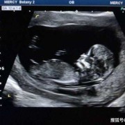 b超看胎儿体重准吗（胎儿体重（克）:482（+-70克）是多少斤）