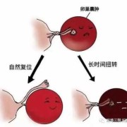 孕期卵巢囊肿怎么办啊,孕期发现卵巢囊肿怎么办啊?