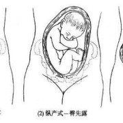 胎儿顶先露图片（宝宝衣服领子大露肩膀怎么缝）