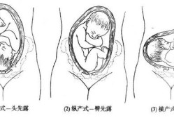 胎儿顶先露图片（宝宝衣服领子大露肩膀怎么缝）