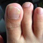 孕期指甲空了（脚指甲空了是怎么回事）