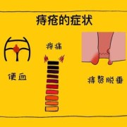 痔疮是如何产生的,孕期痔疮原因有哪些