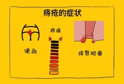 痔疮是如何产生的,孕期痔疮原因有哪些
