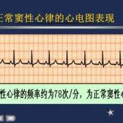 什么是窦性心律?s-t段异常时怎么回事5,胎儿窦性心律什么意思
