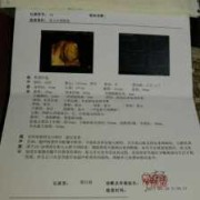 宝宝三维图怎么用ai生成,三维胎儿长相看男女准吗