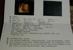 宝宝三维图怎么用ai生成,三维胎儿长相看男女准吗