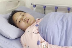 酸中毒孕期（酸中毒 孕妇）