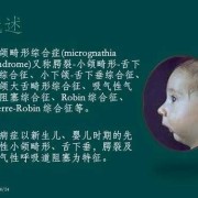 宝宝下颚有点突出怎么办,胎儿下颌小必须引产吗