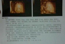 34周早产儿体重，怎么算呢,彩超怎么算胎儿的体重呢