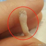 火胎儿（火胎儿的影响）