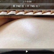 为什么胎儿喜欢鼓包，这是怎么回事呢,胎儿头鼓包大还是屁股大