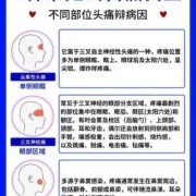 孕期天天头疼（孕30周老是头痛，该怎么办）