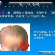 胎儿颅骨呈椭圆形好吗（方颅顶如何判断）