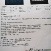 胎动经常在左边动，是什么原因啊,孕期左侧动脉阻力指数增高什么意思