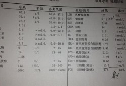 孕期胆酸检查（孕期胆酸检查是查什么）