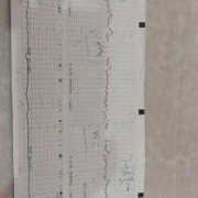 孕35周检查时说胎儿右心房偏大是怎么回事?之前做四维时都没事的，是不是检查错了呢,胎儿右心稍大有危害吗怎么治疗