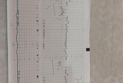 孕35周检查时说胎儿右心房偏大是怎么回事?之前做四维时都没事的，是不是检查错了呢,胎儿右心稍大有危害吗怎么治疗