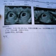 多久胎儿有胎心（多久胎儿有胎心胎芽）