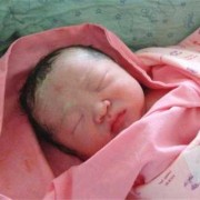 为什么有的婴儿一出生就有鼻梁,胎儿没鼻梁骨说明孩子痴呆